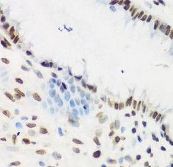 KLF4 Rabbit Polyclonal Antibody