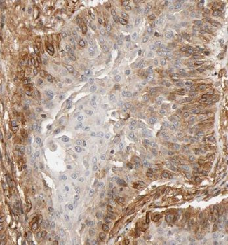 KLHL14 Rabbit Polyclonal Antibody