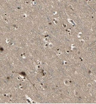 KLHL15 Rabbit Polyclonal Antibody
