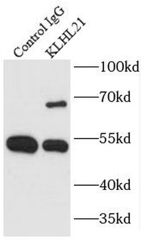 KLHL21 Rabbit Polyclonal Antibody