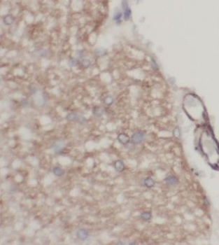 KLHL21 Rabbit Polyclonal Antibody