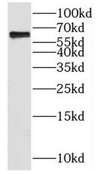 KLHL28 Antibody