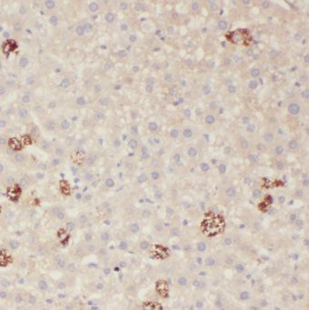 KLHL28 Rabbit Polyclonal Antibody