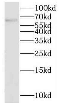 KLHL3 Rabbit Polyclonal Antibody