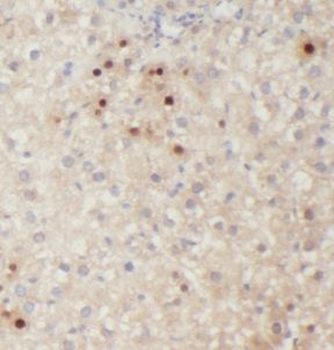 KLHL3 Rabbit Polyclonal Antibody