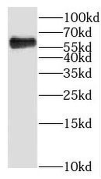KLHL31 Rabbit Polyclonal Antibody
