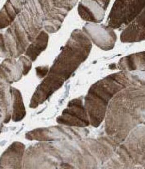 KLHL31 Rabbit Polyclonal Antibody