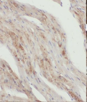 KLHL35 Rabbit Polyclonal Antibody