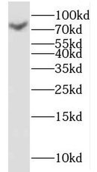 KLHL4 Rabbit Polyclonal Antibody