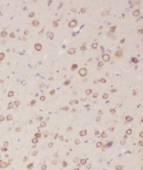 KLHL4 Rabbit Polyclonal Antibody