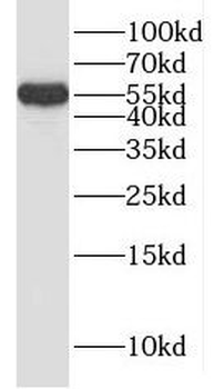 KPNA2 Rabbit Polyclonal Antibody
