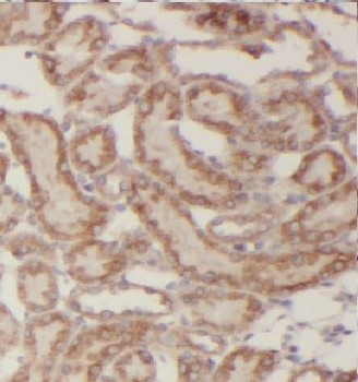 KPTN Rabbit Polyclonal Antibody