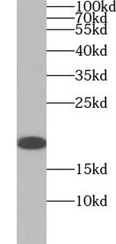 KRAS Rabbit Polyclonal Antibody