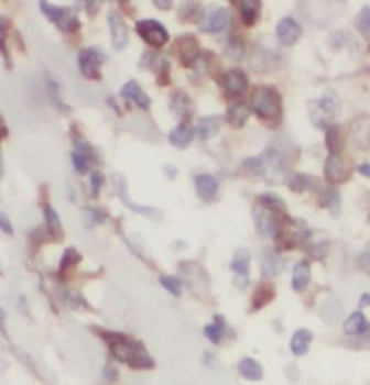 KRAS Rabbit Polyclonal Antibody