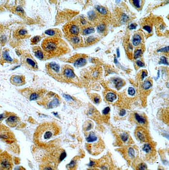 KRT10 Antibody