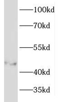 KRT33B Rabbit Polyclonal Antibody