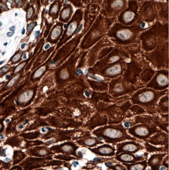 KRT33B Rabbit Polyclonal Antibody