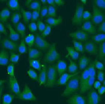 KRT6B Rabbit Polyclonal Antibody