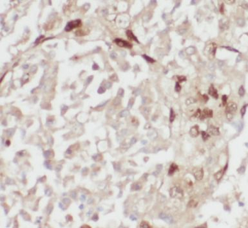 KRT6B Rabbit Polyclonal Antibody