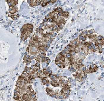 KRT80 Rabbit Polyclonal Antibody