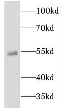 KRT81 Rabbit Polyclonal Antibody