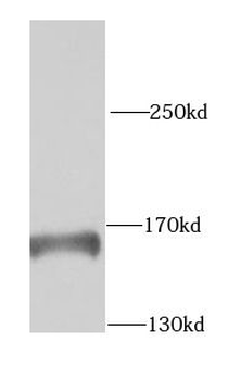 KTN1 Rabbit Polyclonal Antibody