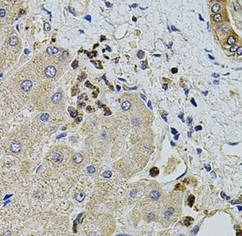 KTN1 Rabbit Polyclonal Antibody