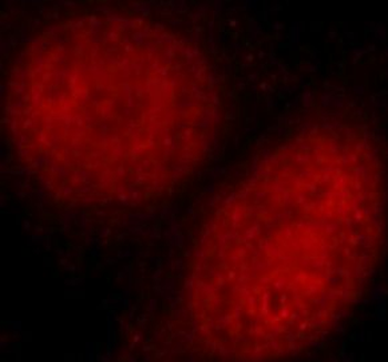 XRCC6 Rabbit Polyclonal Antibody