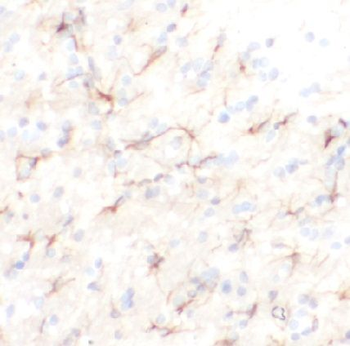 KCND1 Rabbit Polyclonal Antibody