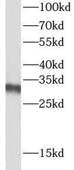 LACTB2 Rabbit Polyclonal Antibody
