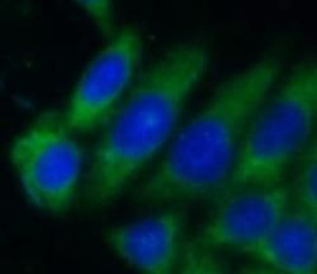 LACTB2 Rabbit Polyclonal Antibody