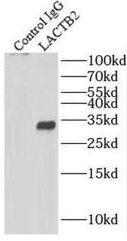 LACTB2 Rabbit Polyclonal Antibody