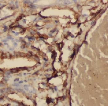 LTF Rabbit Polyclonal Antibody