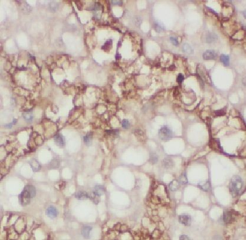 LAMB1 Rabbit Polyclonal Antibody