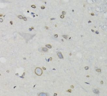 LMNB1 Rabbit Polyclonal Antibody