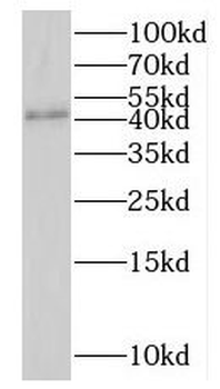LANCL1 Rabbit Polyclonal Antibody