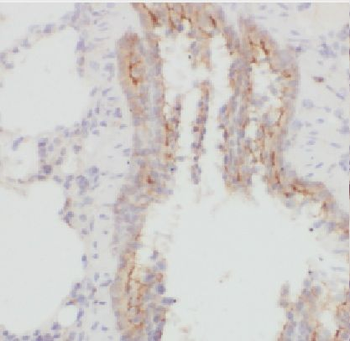 LANCL1 Rabbit Polyclonal Antibody