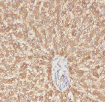 LAPTM4B Rabbit Polyclonal Antibody