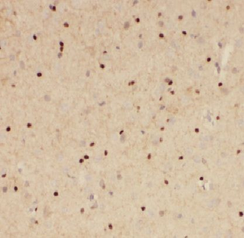 LARP4 Rabbit Polyclonal Antibody