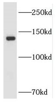 LARS1 Antibody