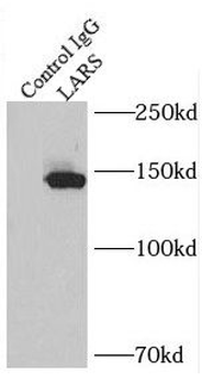 LARS1 Rabbit Polyclonal Antibody
