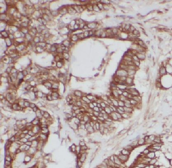 LARS1 Rabbit Polyclonal Antibody