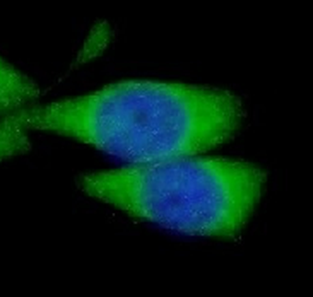 LBP Rabbit Polyclonal Antibody