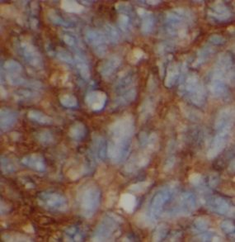 LBP Mouse Monoclonal Antibody