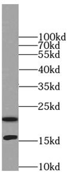LC3 Rabbit Polyclonal Antibody