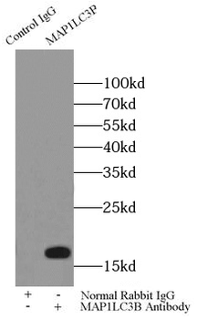 LC3 Rabbit Polyclonal Antibody