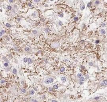 LC3 Rabbit Polyclonal Antibody