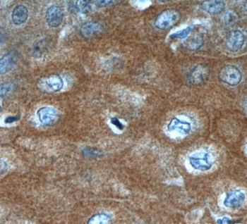 LCE1A Antibody