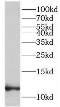 LCE1B Rabbit Polyclonal Antibody
