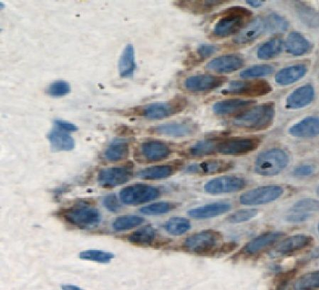 LCE1B Rabbit Polyclonal Antibody